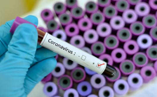 A member of staff at Travel Republic's office in London has tested positive for coronavirus