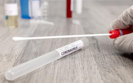 The UK government stresses that it does not "endorse or recommend any specific test provider" on its website