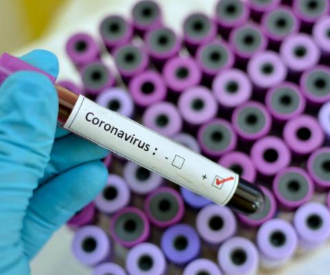 A member of staff at Travel Republic's office in London has tested positive for coronavirus