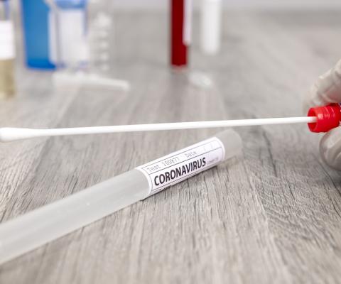 The UK government stresses that it does not "endorse or recommend any specific test provider" on its website